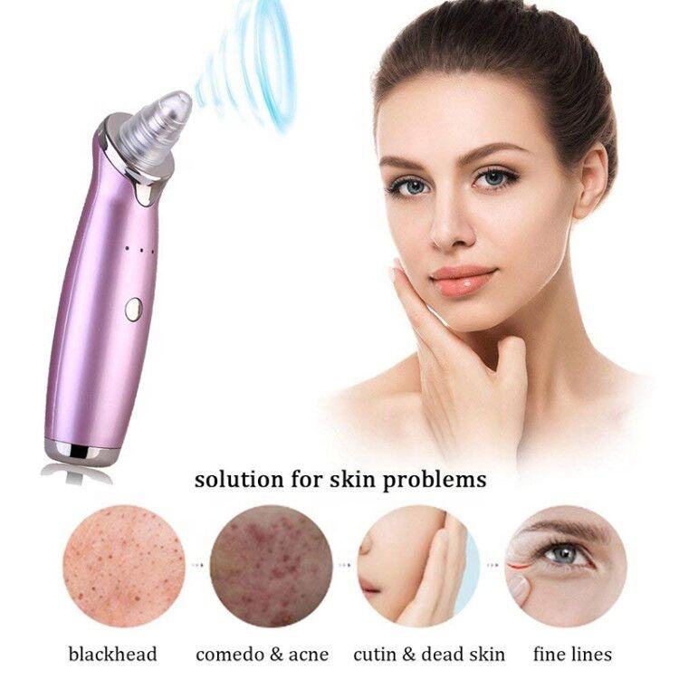 Facial Blackhead Remover Vacuum Pore Adsorber Electric Pimple Blackhead Cleaner USB Rechargeable Water Cycle Face Cleaning Tool
