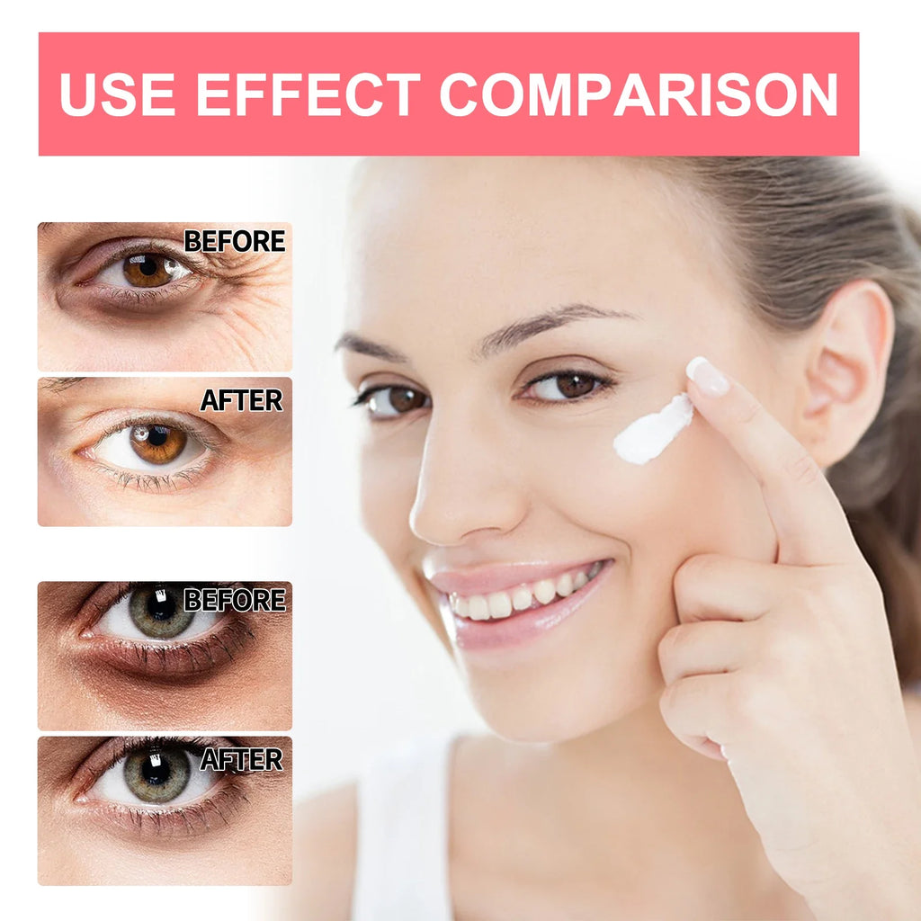 Retinol Eye Cream Stick Lightening Dark Circles Anti-Puffiness Smooth Brightening Moisturizing Firming Under Eye Treatment Care