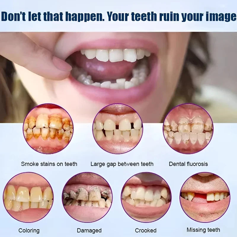 Silicone Full Dentures Natural Upper Lower False Tooth Set Portable Comfort Braces Oral Care for Men Women