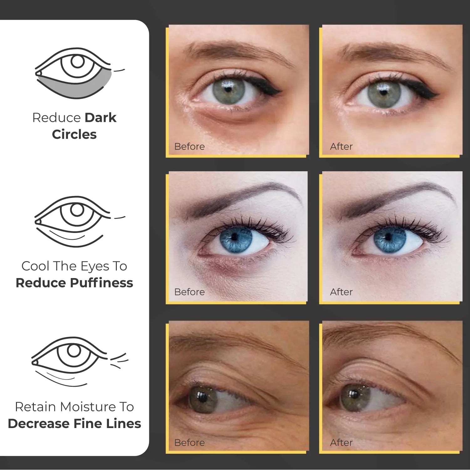 Under Eye Patches for Puffy Eyes and Dark Circles (60 Pairs) | Infused Gel Eye Mask Patches for Dark Circle Under Eye Support of Eye Bags & Puffiness | Ideal for Bridesmaids Gifts & Bachelorette Party