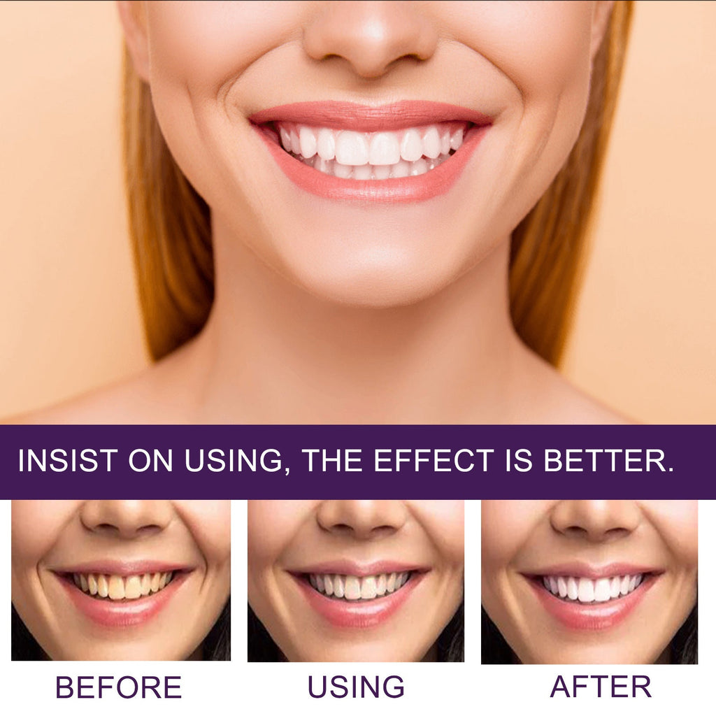 Toothpaste Tooth Stain Removal Cleaning Whitening Anti Pigment Precipitation